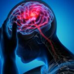 Sénégal Pr Ngor Side Diagne AVC alimentation